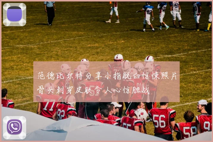 范德比尔特分享小指脱臼惊悚照片骨头刺穿皮肤令人心惊胆战